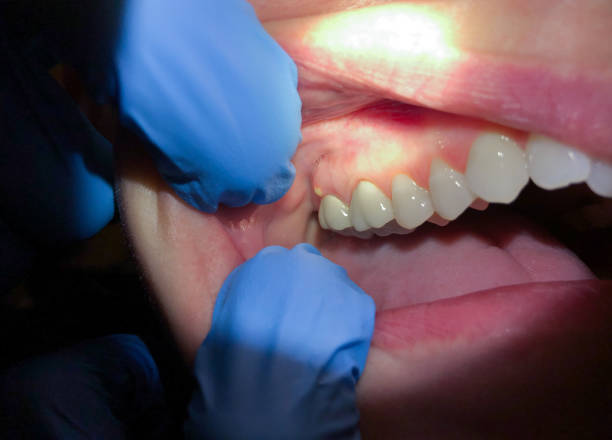 Best Pediatric Emergency Dentist in Decordova, TX