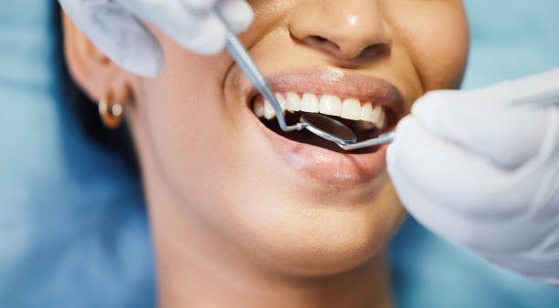 Best Emergency Denture Repair in Decordova, TX